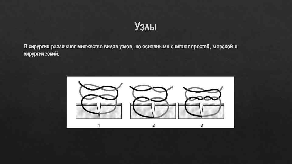 Узлы В хирургии различают множество видов узлов, но основными считают простой, морской и хирургический.