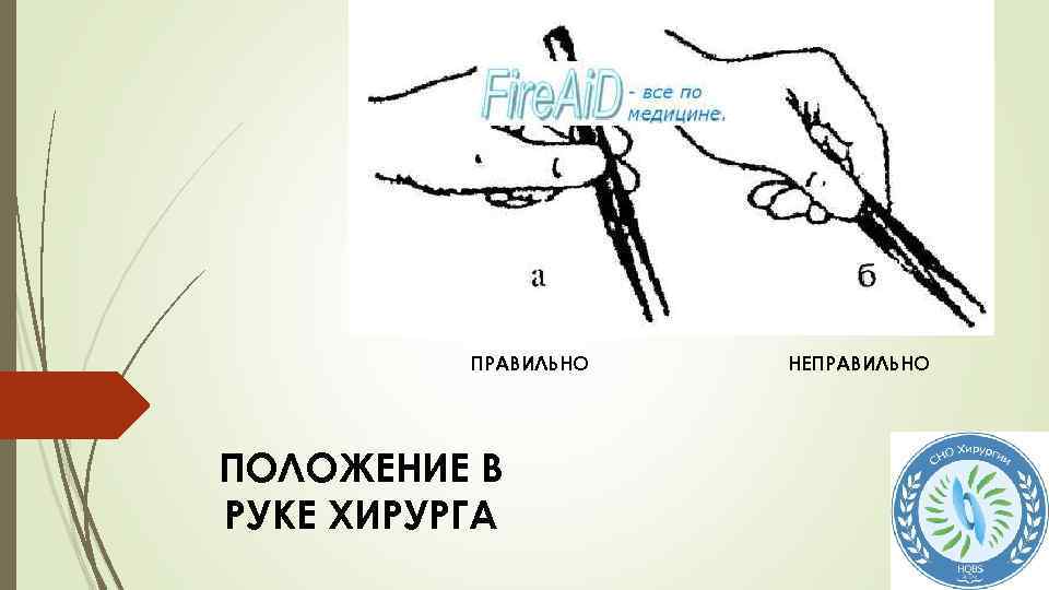 ПРАВИЛЬНО ПОЛОЖЕНИЕ В РУКЕ ХИРУРГА НЕПРАВИЛЬНО 