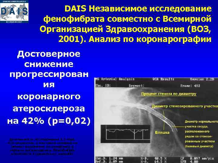 DAIS Независимое исследование фенофибрата совместно с Всемирной Организацией Здравоохранения (ВОЗ, 2001). Анализ по коронарографии