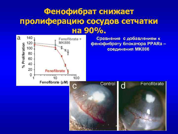 Фенофибрат снижает пролиферацию сосудов сетчатки на 90%. Сравнение с добавлением к фенофибрату блокатора PPARa