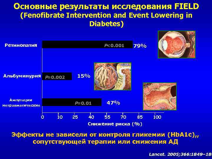 Основные результаты исследования FIELD (Fenofibrate Intervention and Event Lowering in Diabetes) Ретинопатия P <0.