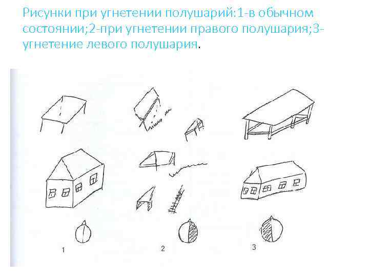 Рисунки при угнетении полушарий: 1 -в обычном состоянии; 2 -при угнетении правого полушария; 3