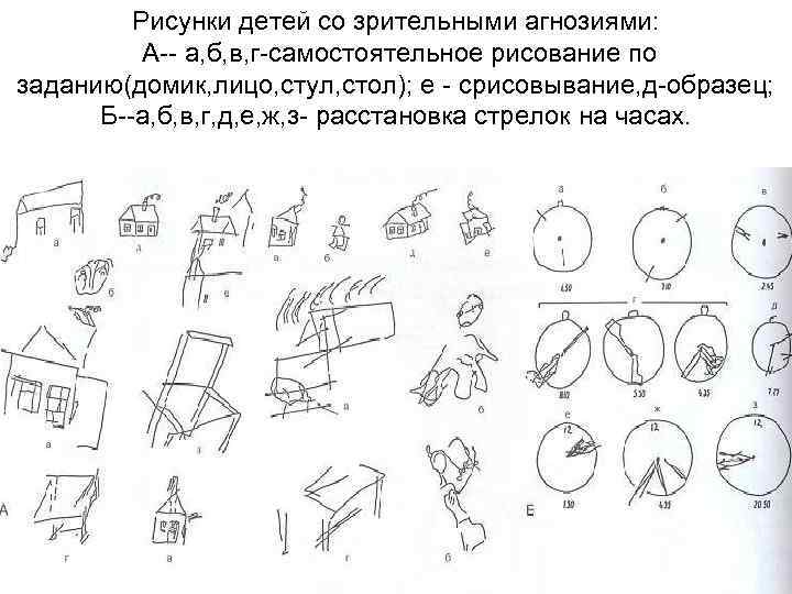 Рисунки детей со зрительными агнозиями: А-- а, б, в, г-самостоятельное рисование по заданию(домик, лицо,