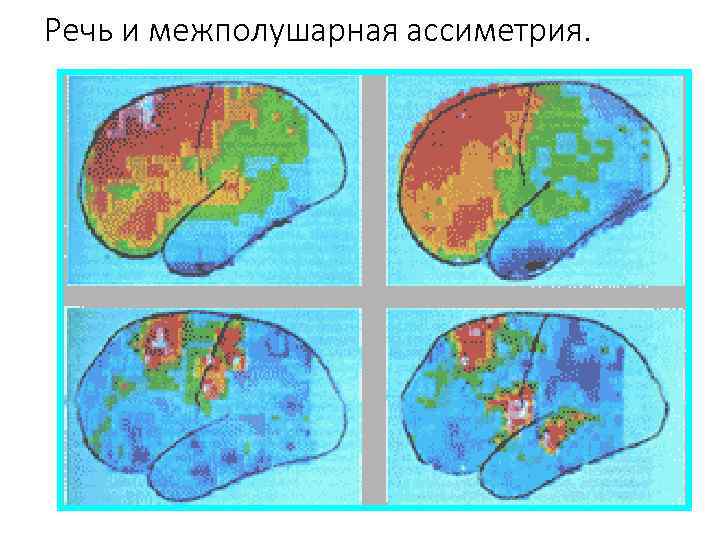 Речь и межполушарная ассиметрия. 