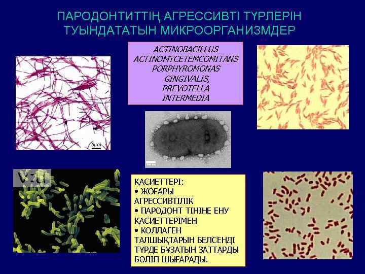 ПАРОДОНТИТТІҢ АГРЕССИВТІ ТҮРЛЕРІН ТУЫНДАТАТЫН МИКРООРГАНИЗМДЕР ACTINOBACILLUS ACTINOMYCETEMCOMITANS PORPHYROMONAS GINGIVALIS, PREVOTELLA INTERMEDIA ҚАСИЕТТЕРІ: • ЖОҒАРЫ
