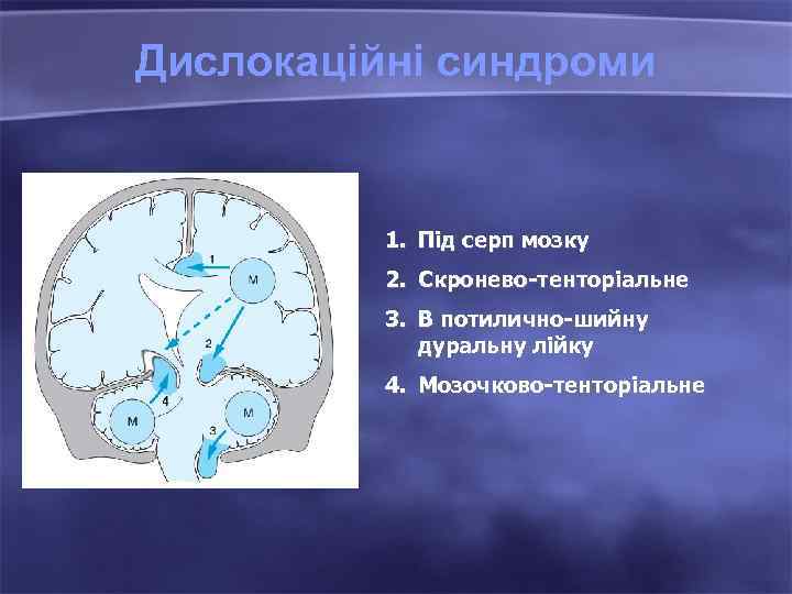 Дислокаційні синдроми 1. Під серп мозку 2. Скронево-тенторіальне 3. В потилично-шийну дуральну лійку 4.