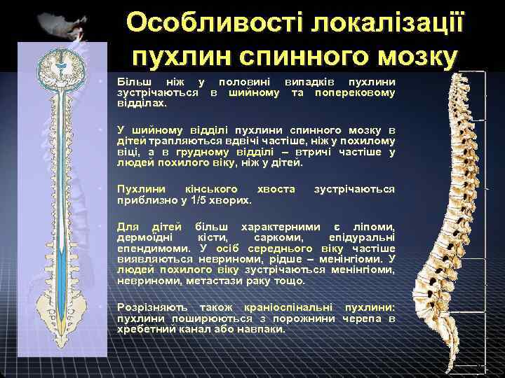 Особливості локалізації пухлин спинного мозку • Більш ніж у половині випадків пухлини зустрічаються в