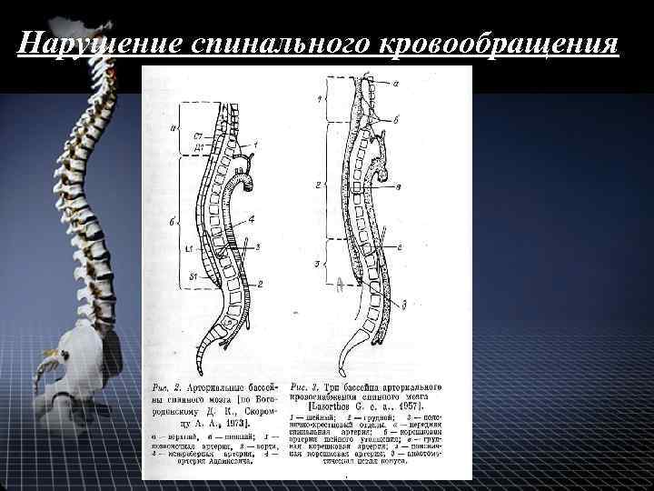 Нарушение спинального кровообращения 