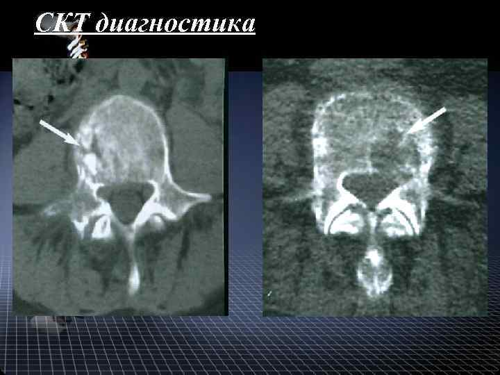 СКТ диагностика 
