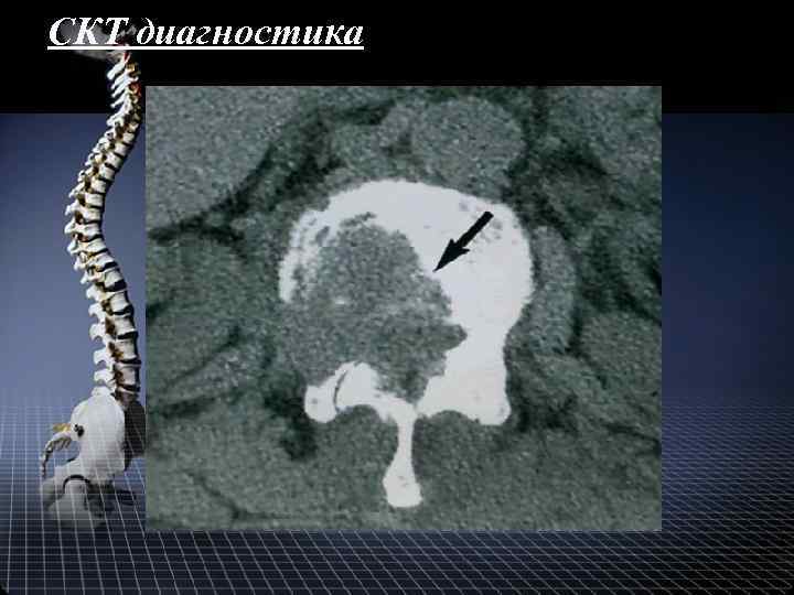 СКТ диагностика 