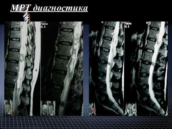 МРТ диагностика 