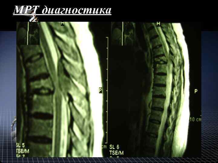 МРТ диагностика 