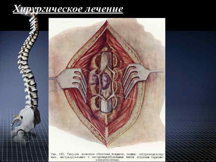 Хирургическое лечение 