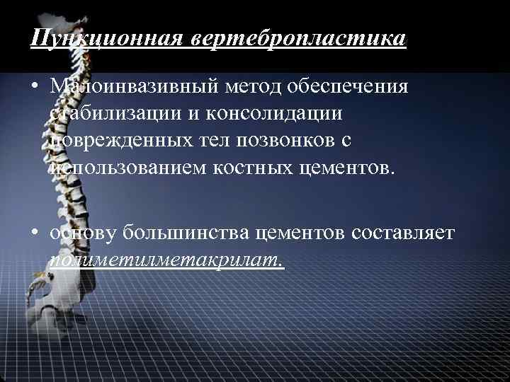 Пункционная вертебропластика • Малоинвазивный метод обеспечения стабилизации и консолидации поврежденных тел позвонков с использованием