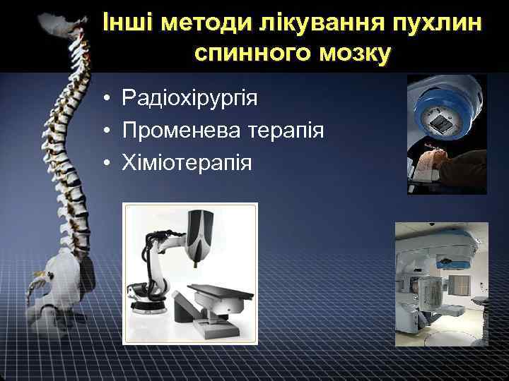 Інші методи лікування пухлин спинного мозку • Радіохірургія • Променева терапія • Хіміотерапія 