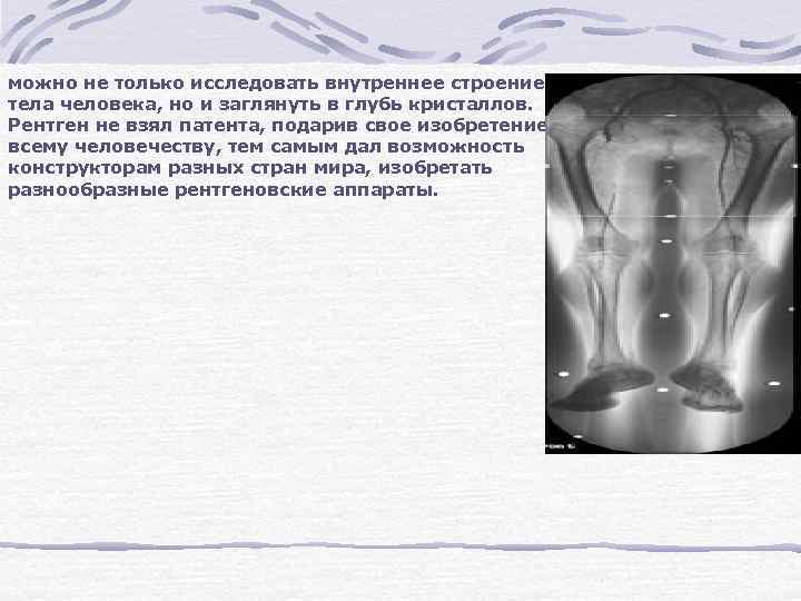можно не только исследовать внутреннее строение тела человека, но и заглянуть в глубь кристаллов.