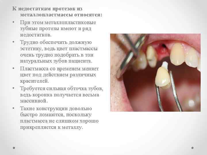 Курсовая работа: Реставрация зубов