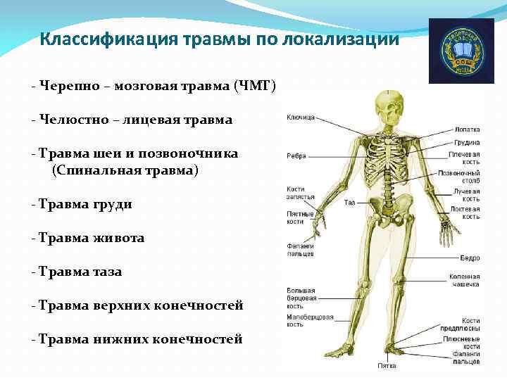 Классификация травм по локализации схема