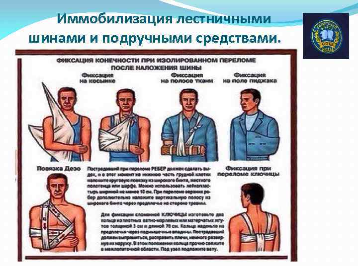 Иммобилизация лестничными шинами и подручными средствами. 