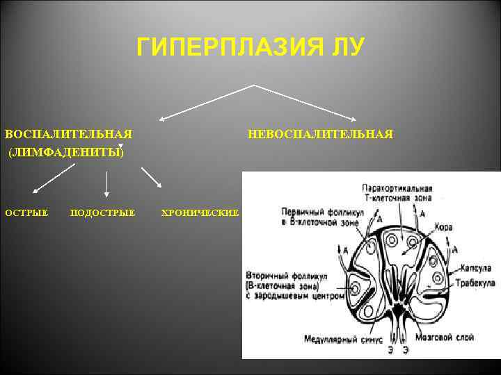 ГИПЕРПЛАЗИЯ ЛУ ВОСПАЛИТЕЛЬНАЯ (ЛИМФАДЕНИТЫ) ОСТРЫЕ ПОДОСТРЫЕ НЕВОСПАЛИТЕЛЬНАЯ ХРОНИЧЕСКИЕ 