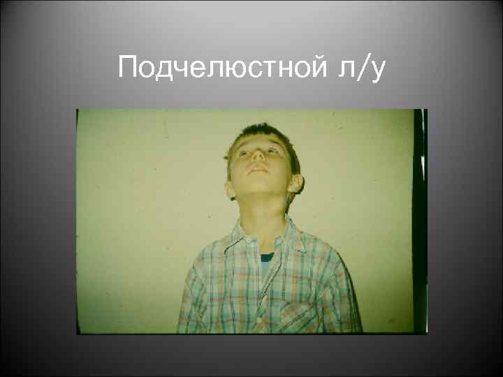 Подчелюстной л/у 