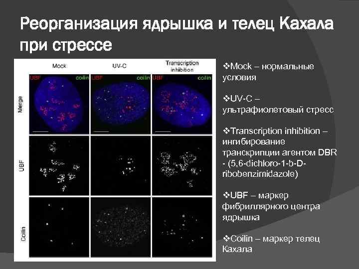 Реорганизация ядрышка и телец Кахала при стрессе v. Mock – нормальные условия v. UV-C