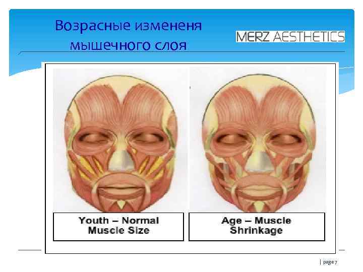 Возрасные измененя мышечного слоя | page 7 