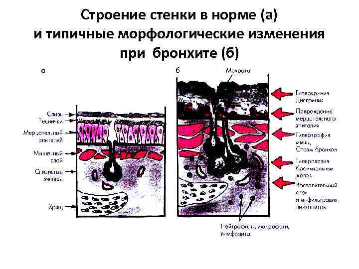 Два главных морфологических отличия стенки дыхательных органов