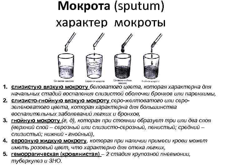 Мокрота (sputum) характер мокроты 1. слизистую вязкую мокроту беловатого цвета, которая характерна для начальных