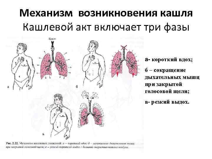 Схема кашлевого рефлекса