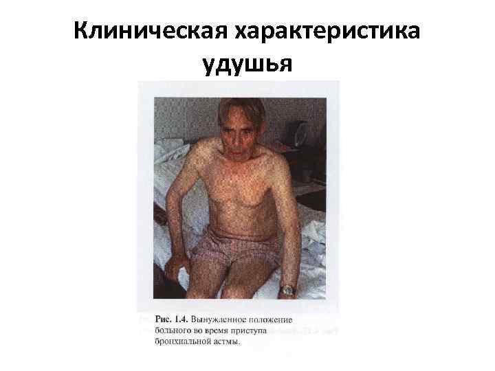 Клиническая характеристика удушья 