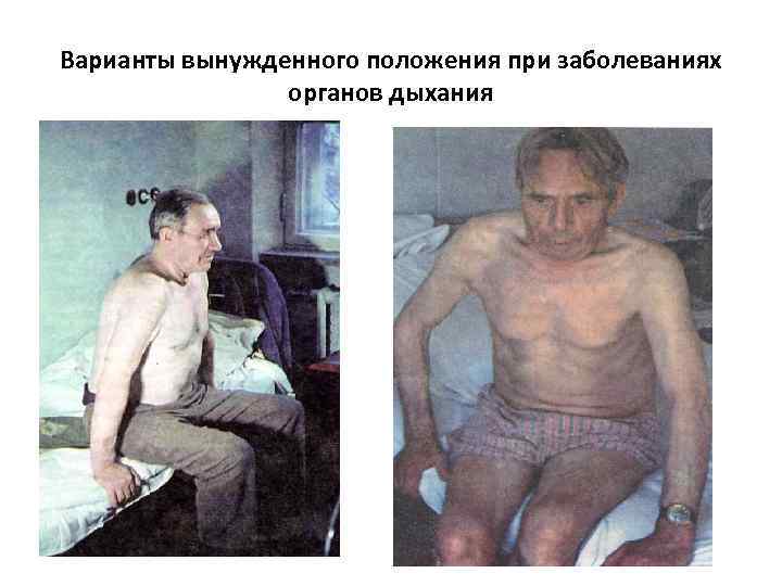 Варианты вынужденного положения при заболеваниях органов дыхания 