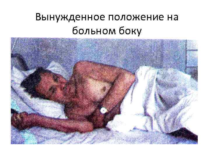 Вынужденное положение на больном боку 