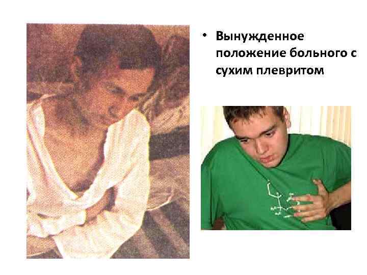  • Вынужденное положение больного с сухим плевритом 