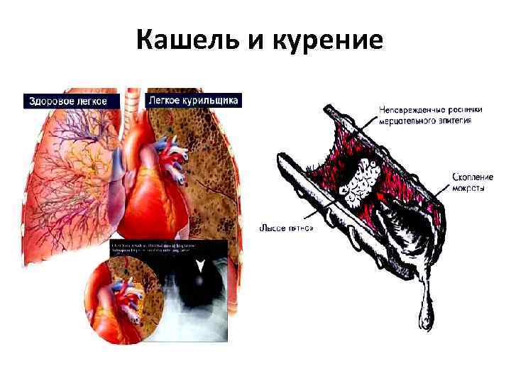 Кашель и курение 