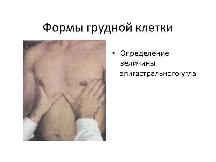 Формы грудной клетки • Определение величины эпигастрального угла 