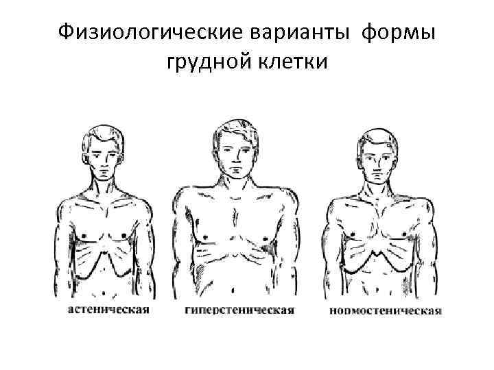 Физиологические варианты формы грудной клетки 