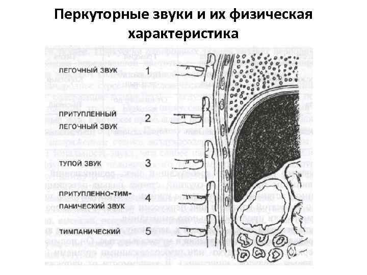 Перкуторные звуки и их физическая характеристика 