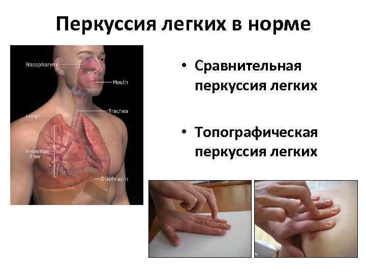 Перкуссия легких в норме • Сравнительная перкуссия легких • Топографическая перкуссия легких 
