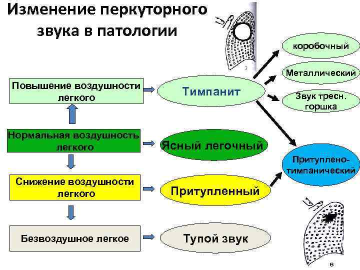 Изменение перкуторного звука в патологии коробочный Металлический Повышение воздушности легкого Тимпанит Нормальная воздушность легкого