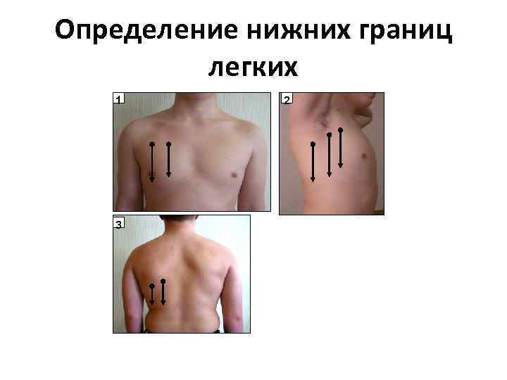Определение нижних границ легких 1 3 2 