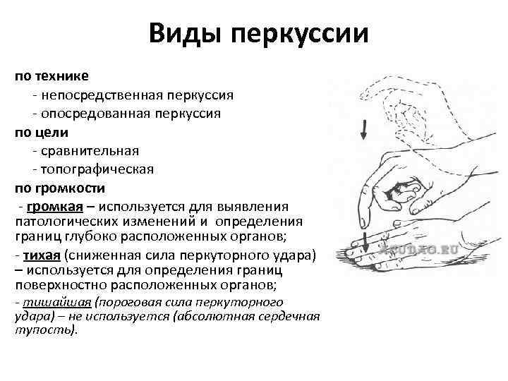 Виды перкуссии по технике - непосредственная перкуссия - опосредованная перкуссия по цели - сравнительная