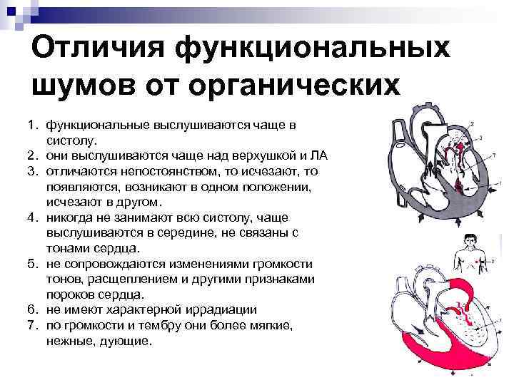 Отличия функциональных шумов от органических 1. функциональные выслушиваются чаще в систолу. 2. они выслушиваются