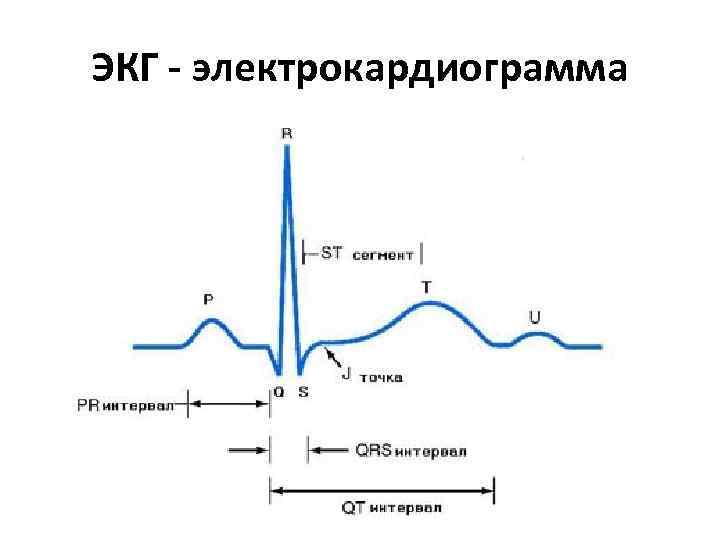ЭКГ - электрокардиограмма 