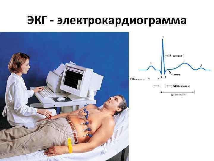 ЭКГ - электрокардиограмма 