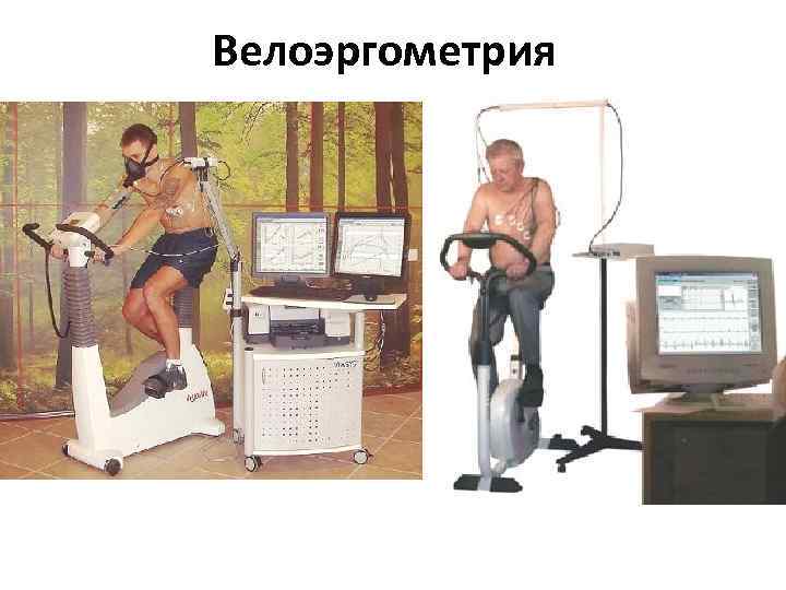 Велоэргометрия 