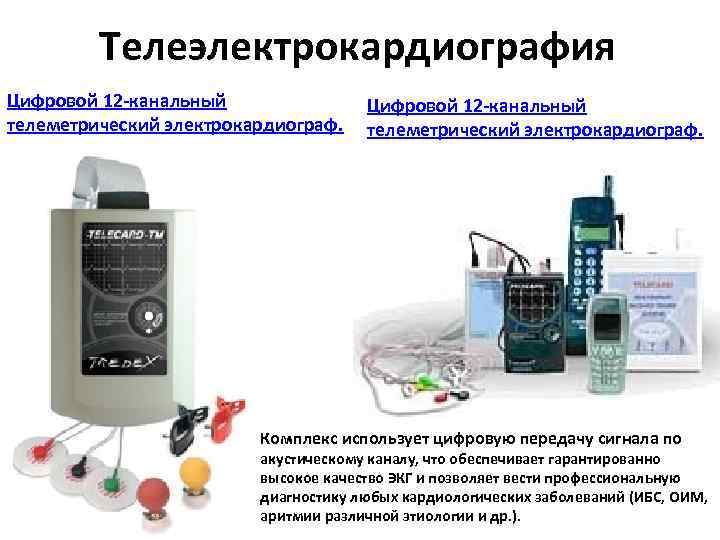 Телеэлектрокардиография Цифровой 12 -канальный телеметрический электрокардиограф. Комплекс использует цифровую передачу сигнала по акустическому каналу,
