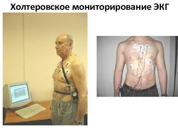 Холтеровское мониторирование ЭКГ 