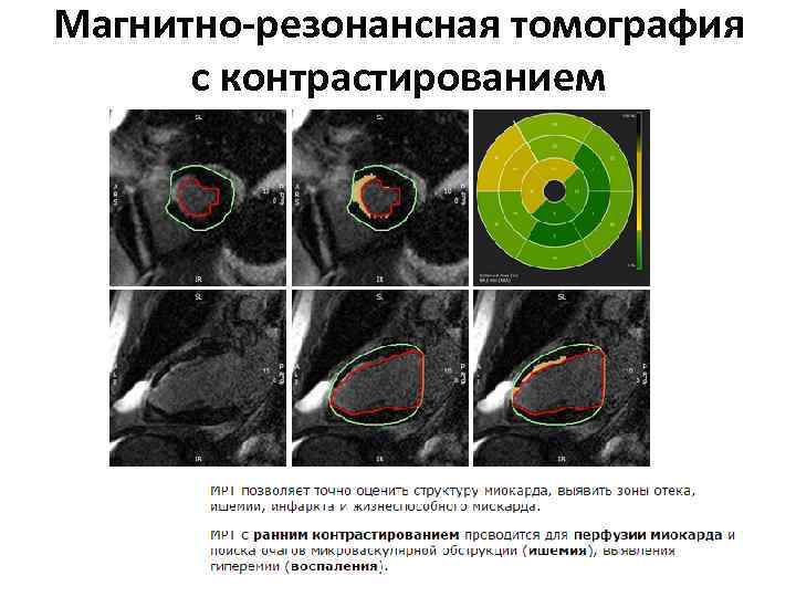 Магнитно-резонансная томография с контрастированием 