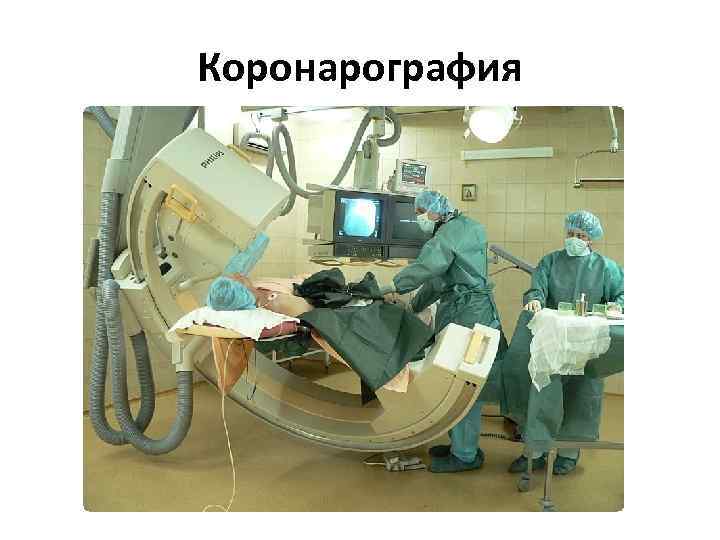 Коронарография 